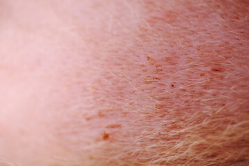 Fototapeta premium Shaving cat fur before apply antiseptic on wound