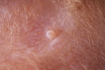 Fototapeta premium Shaving cat fur before apply antiseptic on wound