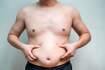 Naklejka premium Overweight man pinches abdominal fat with both hands while standing against plain background. Shirtless body highlights excess weight and unhealthy lifestyle concerns.