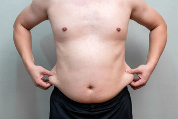 Naklejka premium Overweight man pinches abdominal fat with both hands while standing against plain background. Shirtless body highlights excess weight and unhealthy lifestyle concerns.