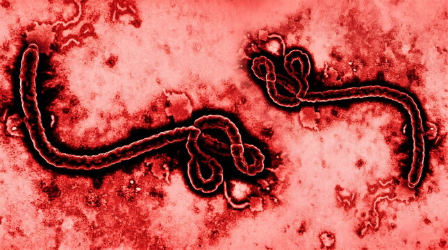 Color electron micrograph of the Ebola virus, a highly dangerous filamentous filovirus that causes hemorrhagic fever.