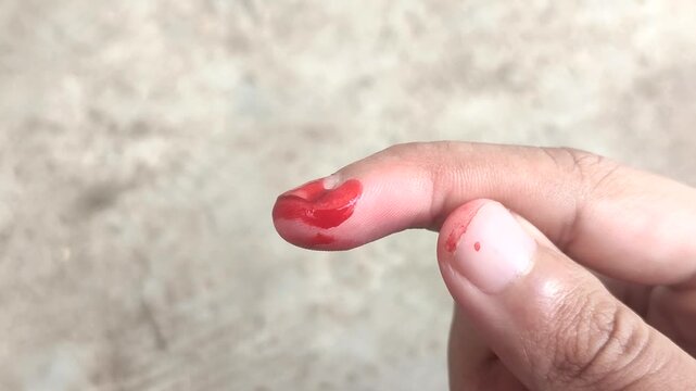 Blood dripping from the fingertip. Suitable for medical concepts, first aid, injuries, laboratory tests, or blood donation