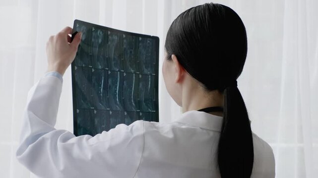 Asian Female Doctor in White Coat Reviewing X-ray Image