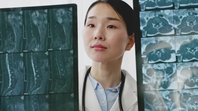 Asian Female Doctor in White Coat Reviewing X-ray Image