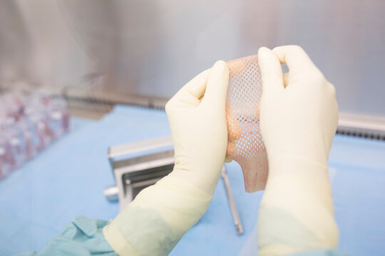 Scientist processing skin graft in laboratory