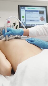 Close up video of cosmetic microdermabrasion back treatment for post acne scars, professional skincare procedure in beauty clinic