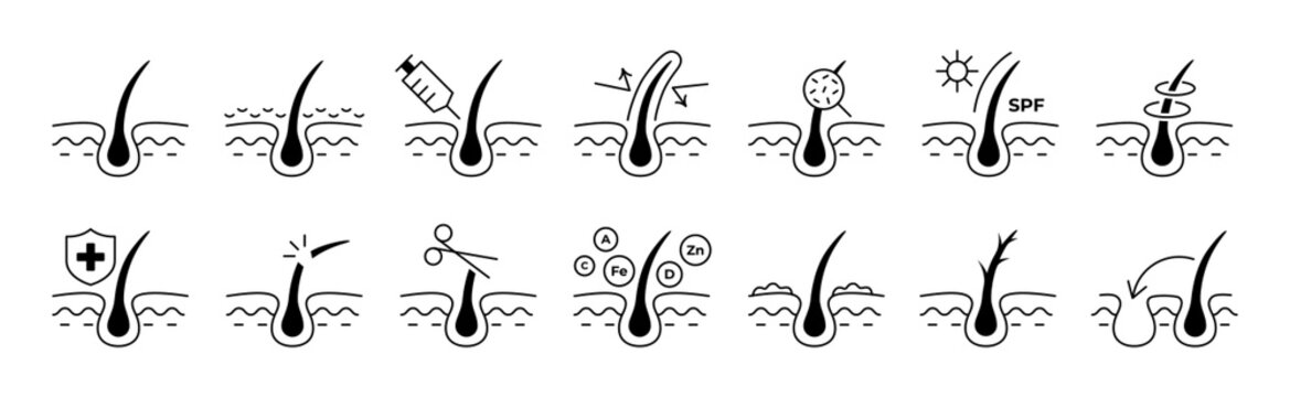 Vector set of hair follicle treatment icons. Dandruff, split ends, healthy scalp, dermatology therapy, head care, repair skin, damage condition outline symbols. Haircut, root growth line art elements