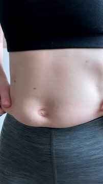 Vertical video. Close-up. Woman pinches her stomach. The beginning of summer. Striving for a healthy lifestyle, proper nutrition and regular physical activity before onset of warm abd beach days