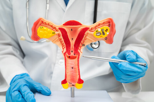 Uterus, doctor with anatomy model for study diagnosis and treatment in hospital.