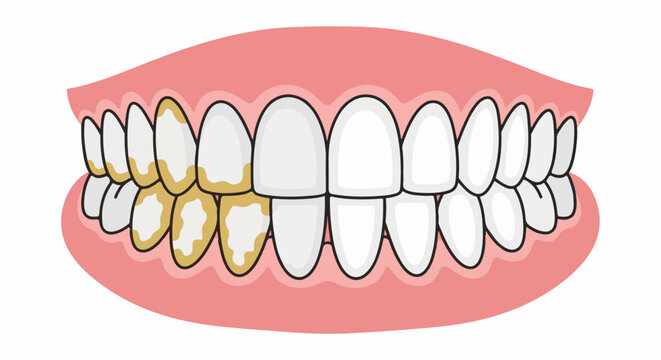 A cartoon illustration of a human mouth with healthy and unhealthy teeth