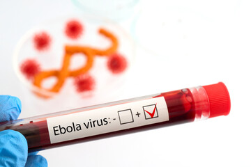 Fototapeta na wymiar Hand holding blood sample showing positive ebola virus test