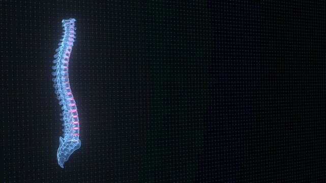 4k Video Intervertebral Discs in Digital Spine Visualization &ndash; Concept of Disc Degeneration and Back Disorders. ProRes 4444.