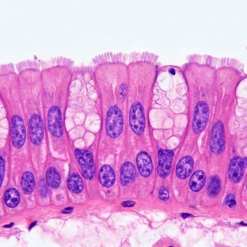 Representative image of goblet cells of the intestine