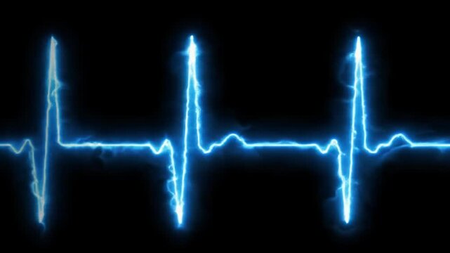 A vibrant, self-illuminated neon blue ecg line with perfectly synchronized peaks and valleys pulses rhythmically across an infinite inky black void. Futuristic medical aesthetic