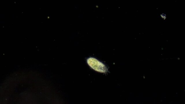 The ciliate spins in place in the water using cilia. The microscope enlarged and showed how the ciliate moves.