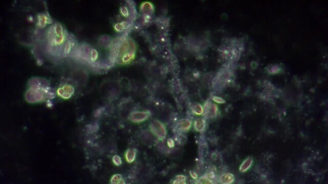 Euglena viridis cells move rapidly and attach to a substrate when a drop of lake water is magnified under a microscope.