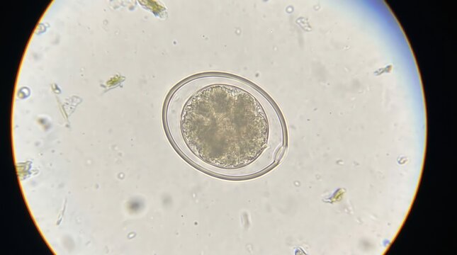Eimeria Coccidia Oocyst Fecal Float Veterinary Stool. Eimeria species unsporulated oocyst with visible micropyle in flotation preparation from clinical veterinary diarrheal stool.