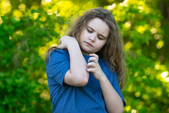 Itching arm shows irritated skin. Child itching follows bug bite. Itching discomfort creates scratching reaction. Itching problem fits dermatology concept.