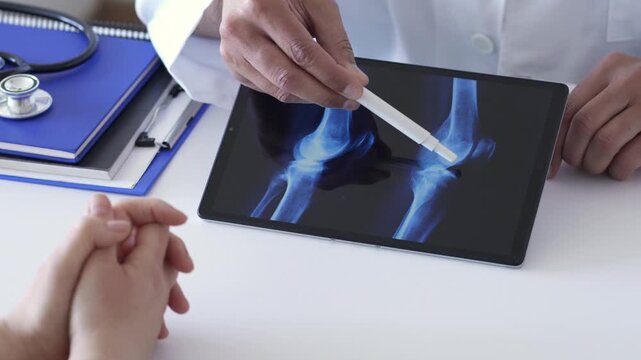 doctor and tablet for x ray with knee, scan or osteoporosis with point at hospital. People, application and ux for medical consultation for arthritis, feedback or report for wellness at clinic