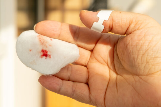 Tiny cut on fingertip, Close up injured thumb with bleeding skin, splinter wound on finger detail, painful hand injury, medical first aid, hygiene awareness, personal care, everyday accident