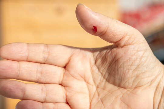 Tiny cut on fingertip, Close up injured thumb with bleeding skin, splinter wound on finger detail, painful hand injury, medical first aid, hygiene awareness, personal care, everyday accident