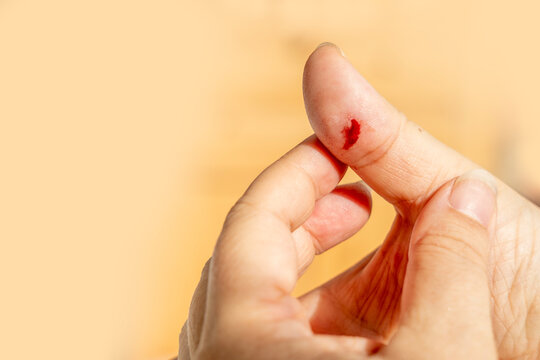 Tiny cut on fingertip, Close up injured thumb with bleeding skin, splinter wound on finger detail, painful hand injury, medical first aid, hygiene awareness, personal care, everyday accident