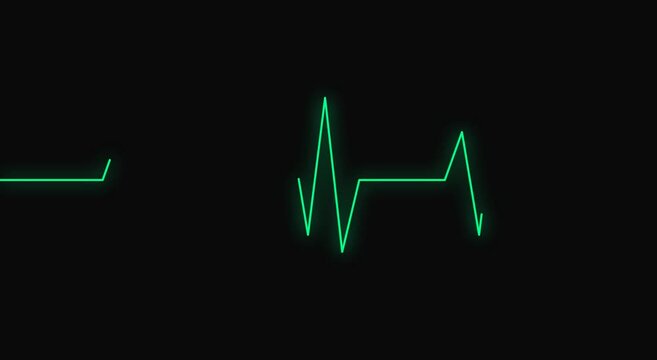 Green heartbeat ekg monitor pulse line animation on animation black background