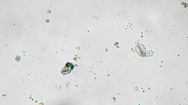 Microscopic diatoms with translucent silica shells scattered across slide, varied shapes and sizes, delicate frustules and algae cells visible, brightfield microscopy for taxonomy and environmental