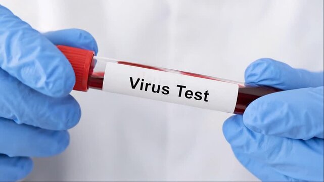 Blood sample tube held by lab worker for virus testing