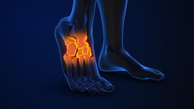 Talus and navicular joint pain affecting Tarsal bones