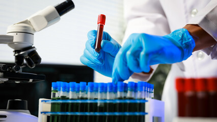 Scientist in lab coat and blue gloves holding blood sample tube near rack of test tubes and microscope, biomedical research or diagnostics concept. © Phushutter