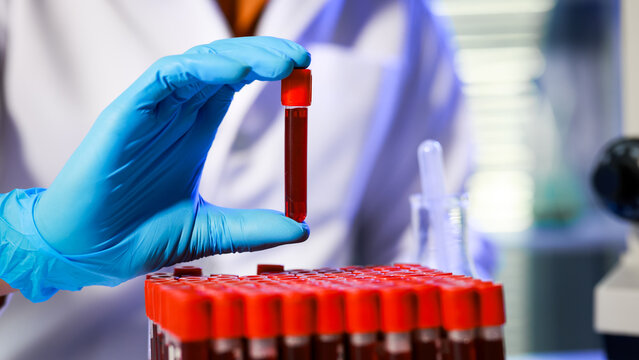 Gloved lab technician holds blood sample vial above a rack of red-top test tubes in a clinical laboratory, shallow depth of field, medical diagnostics and research concept.