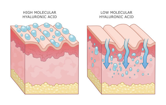 Hyaluronic acid types effect on human skin tissue cross section diagram, vector illustration. Care and beauty series.