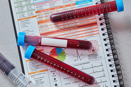 Blood sample test tubes on medical report with ECG analysis chart