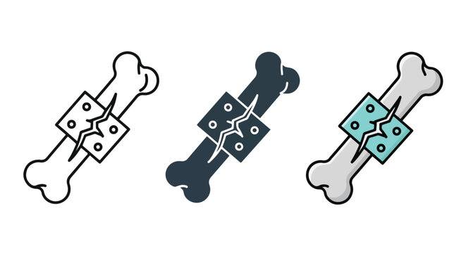 Three styles of broken bone fixation icon - Glyph solid icon - Editable modern style icon - Clipart, sticker - icon set - Clipart
