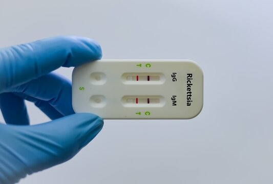 Blood sample tube for rickettsia.