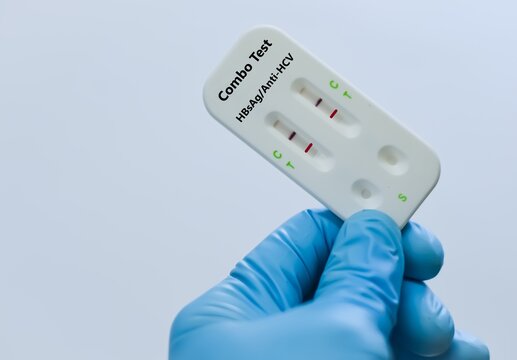 Blood sample of patient positive result for HBsAg and HCV.