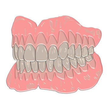 Complete Removable Denture Model with Gloss Finish - Maxillary and Mandibular Prosthesis side View