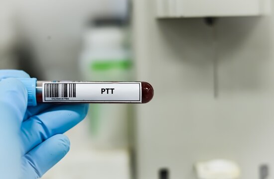 Blood sample tube for PTT test analysis.