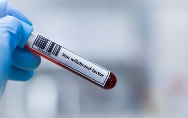 Fototapeta premium Blood sample tube for von wlillebrand factor test analysis.