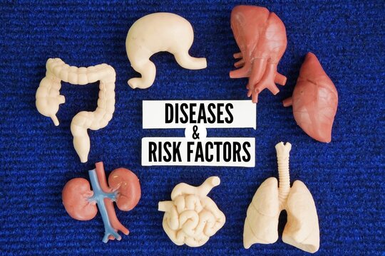 Human internal organs and paper with the words diseases and risk factors. Modifiable lifestyle factors such as an unhealthy diet, lack of exercise, smoking, and alcohol consumption