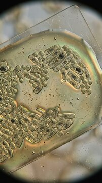 Exploring magnific ultrarealistic bacteria virus fungus and parasite interactions under the microscope