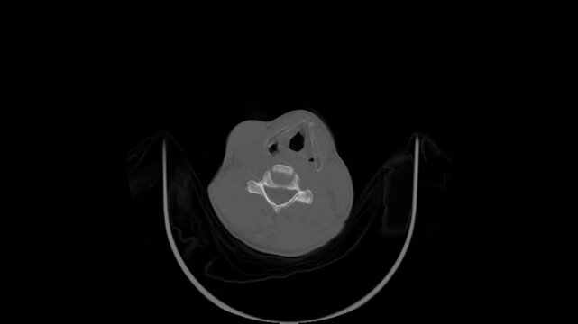 CT Scan of Human Brain Video Showing Axial Slice Head Anatomy