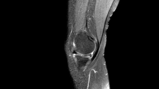 Right Knee MRI Scan Animation Displaying Musculoskeletal Joint Anatomy