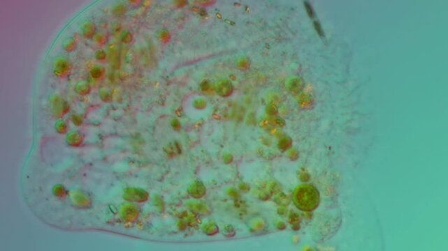 Ciliate sp. at 50x under DIC microscopy video