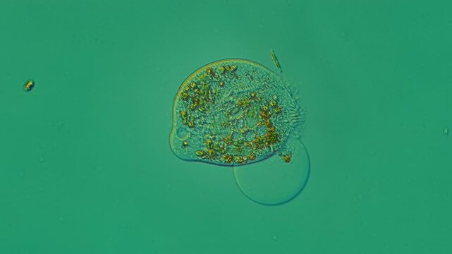 Ciliate sp. at 20x under DIC microscopy video