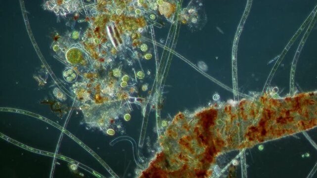 Algae at 20x under darkfield microscopy video