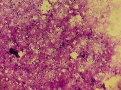  Lactobacillus Gram-Stained Bacteria Rods Under Microscope