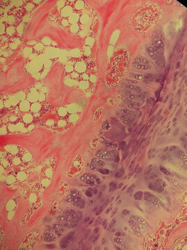 Fibrocartilage Tissue Histology Section Hematoxylin Eosin Stain