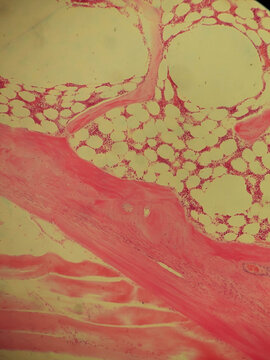 Fibrocartilage Tissue Histology Section Hematoxylin Eosin Stain